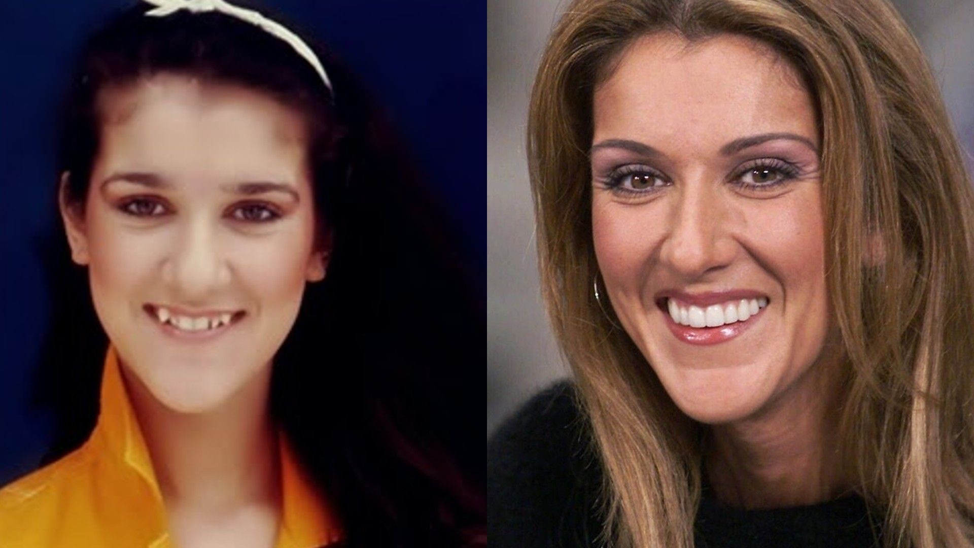 Celine Dion tenía mala dentadura