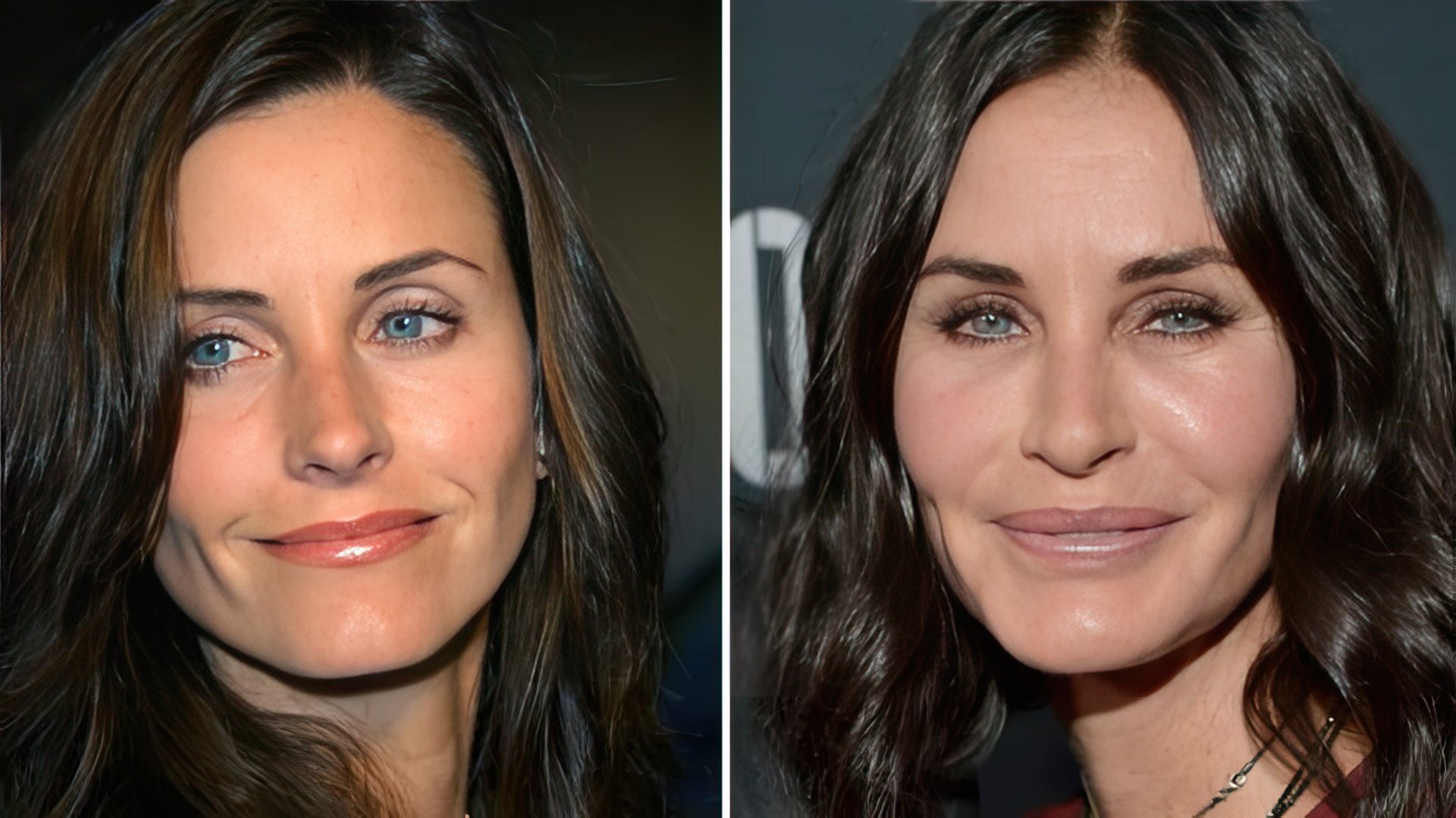 Courteney Cox antes y después de la cirugía plástica