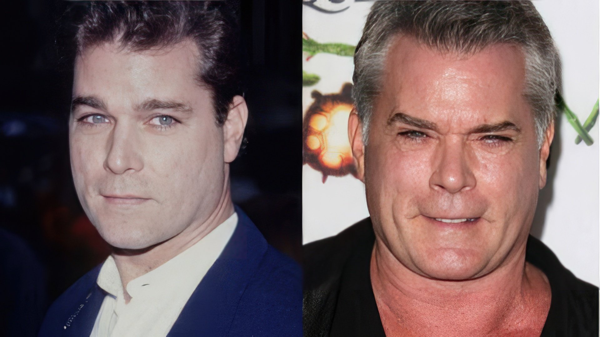 Ray Liotta antes y después de la cirugía plástica